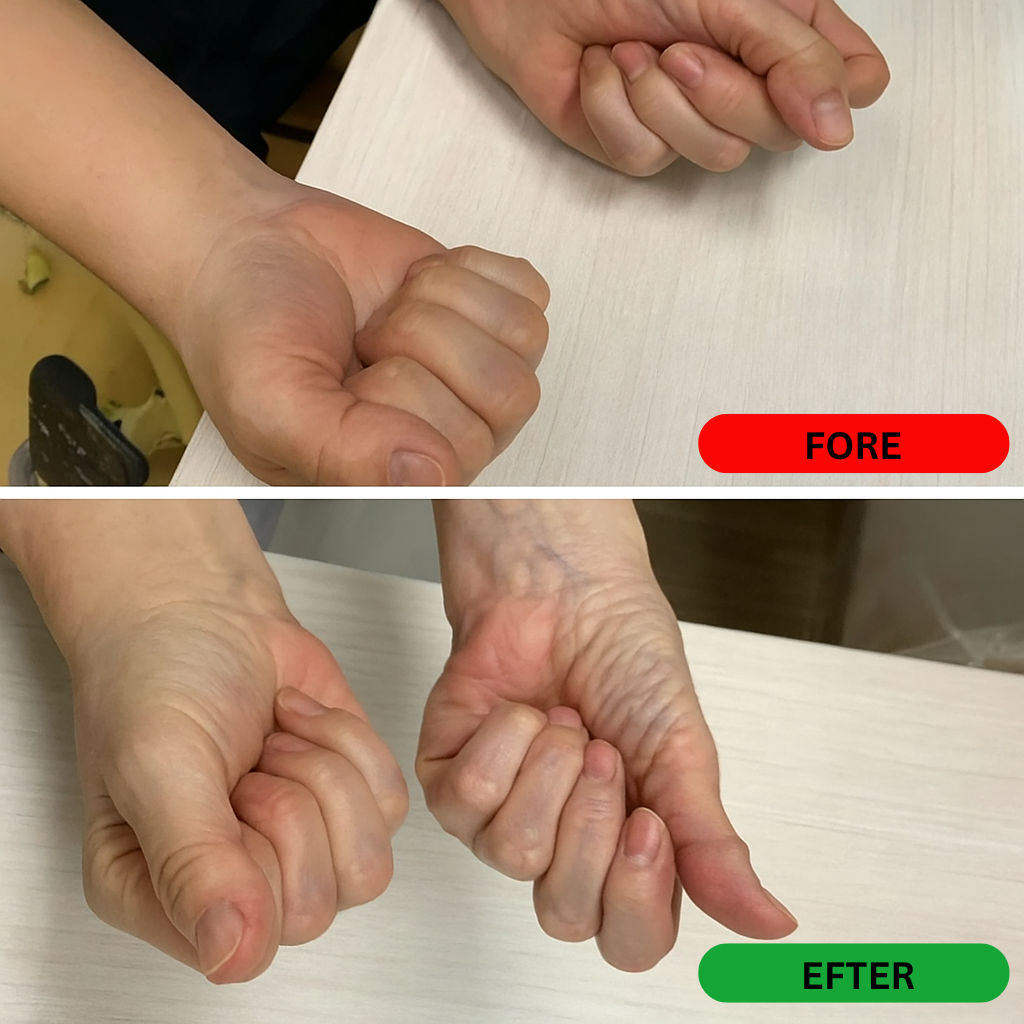 Thermowrist